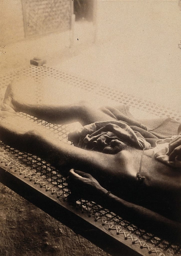 man plague lying rattan bed